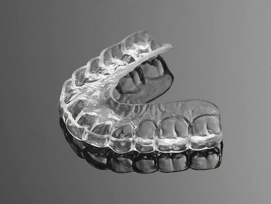 SureSmile Aligners